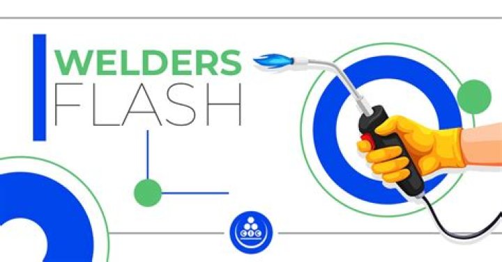 How do you treat welders flash?