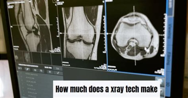 How much do Xray techs make in the US?