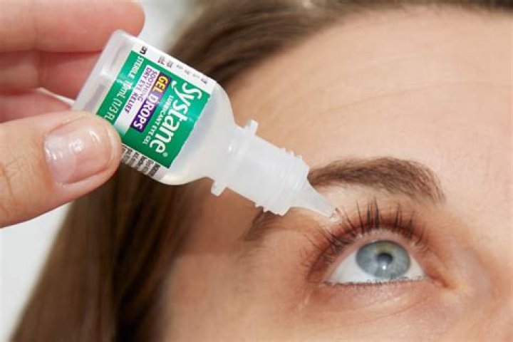 What eye drops to use for welders flash?